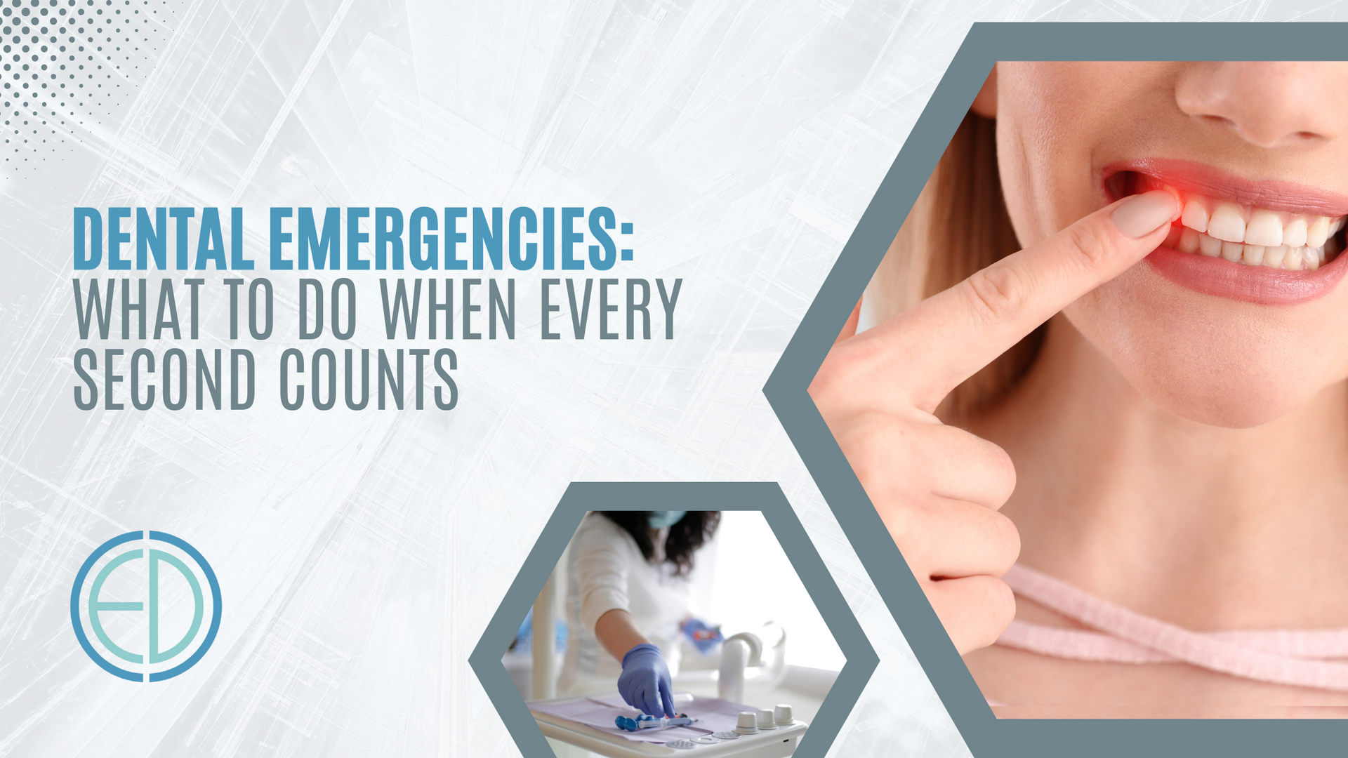 Dental emergencies : what to do when every second counts