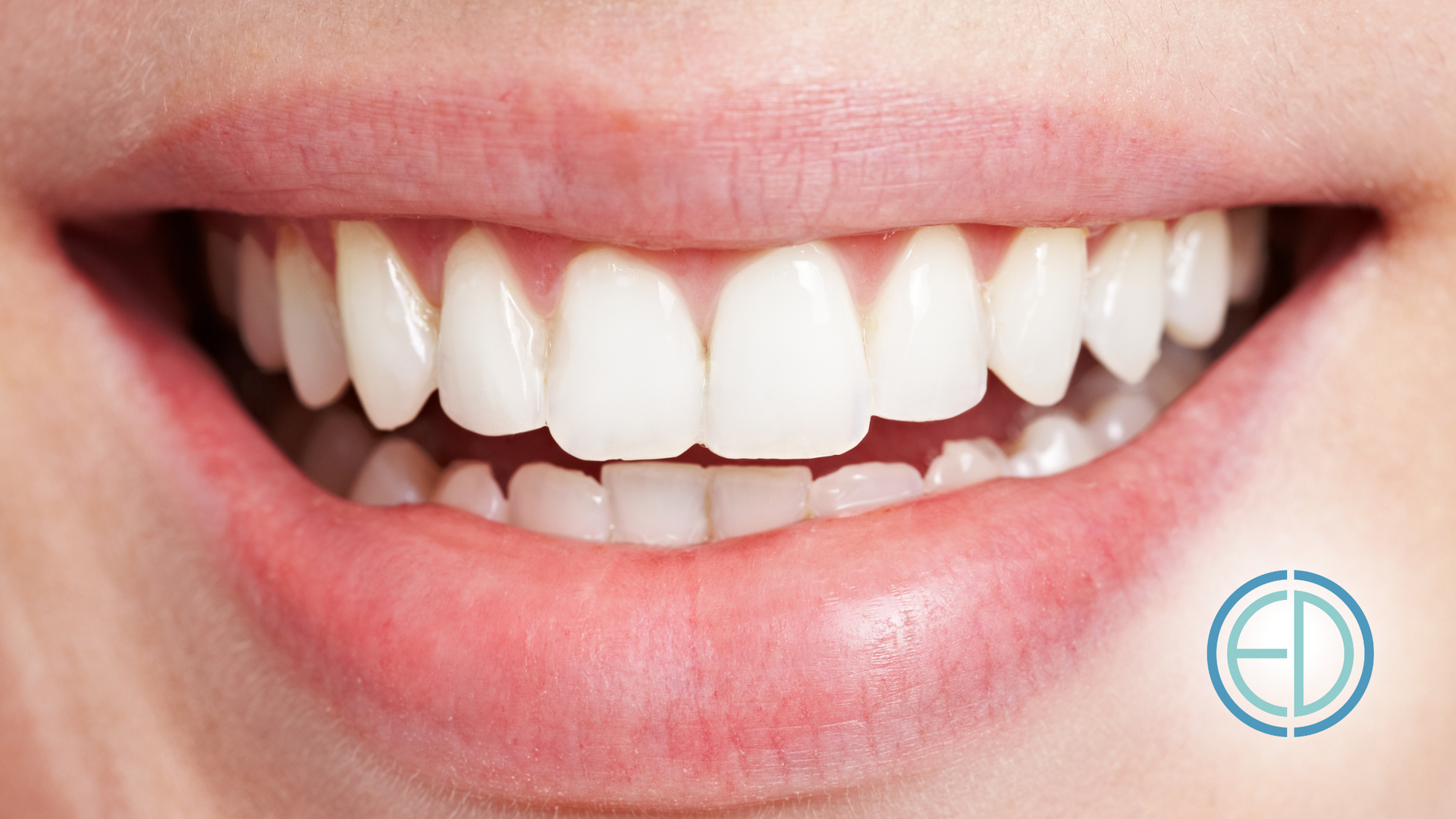 Smiling mouth with straight, white teeth. Pink lips, natural skin tone.