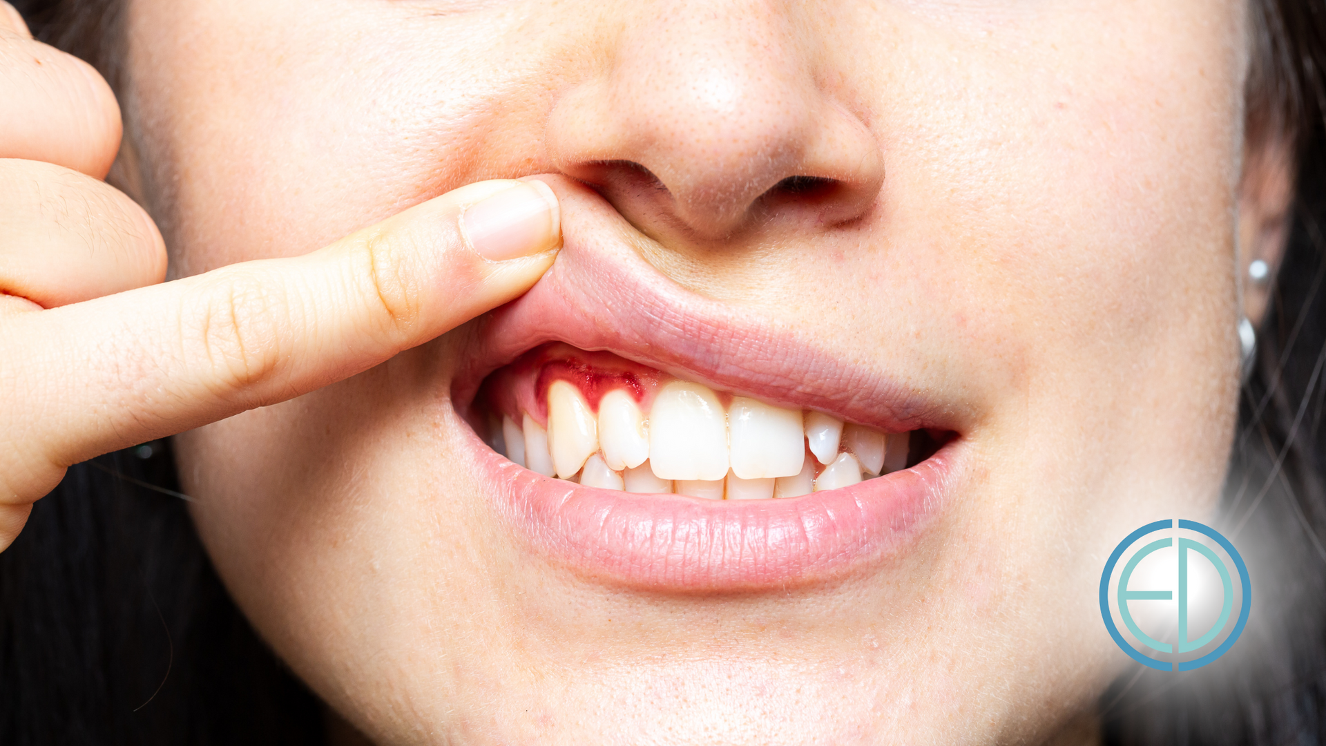 A woman is pointing at her mouth with her finger.