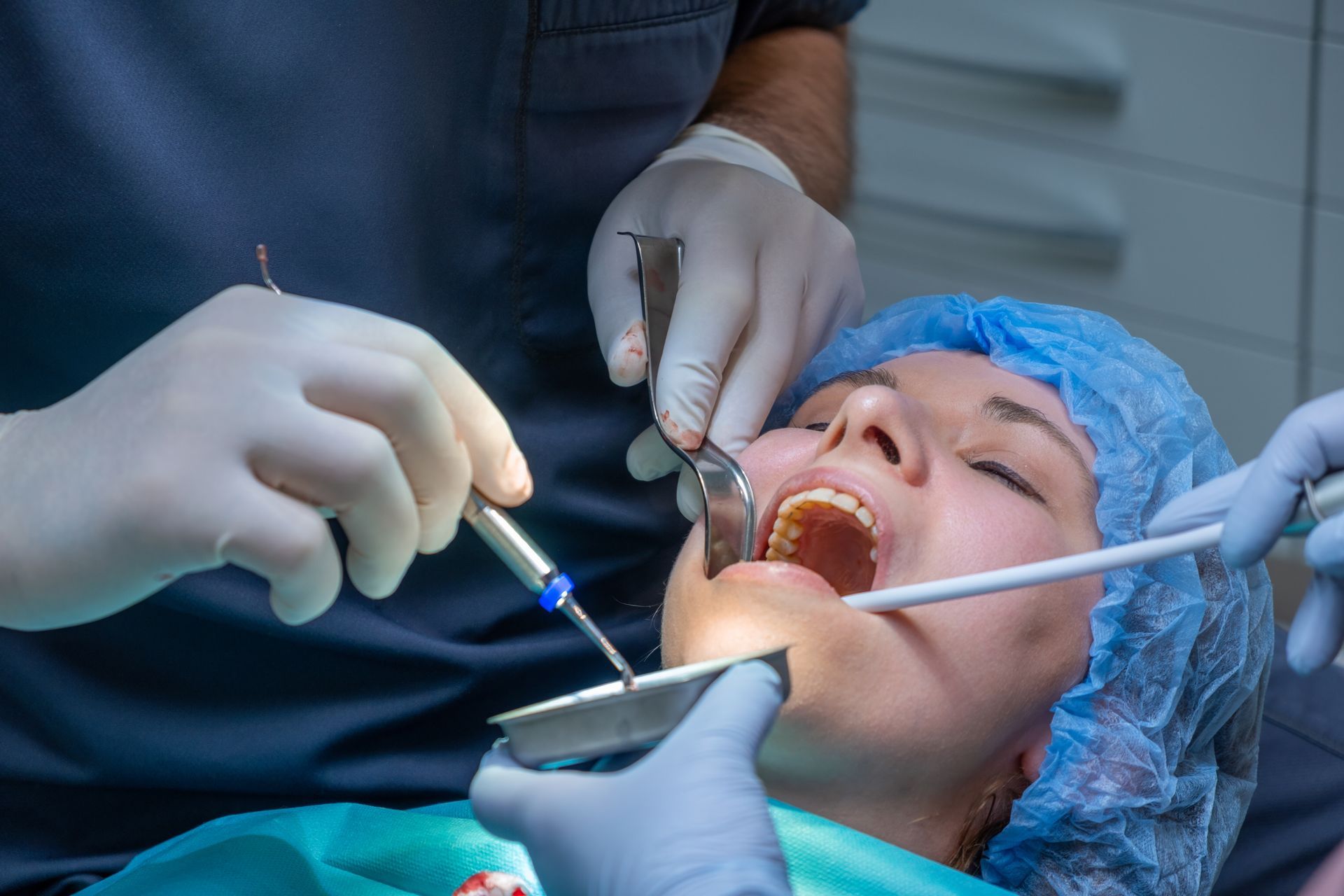 A dental professional works on a patient's mouth during application of bone graft material