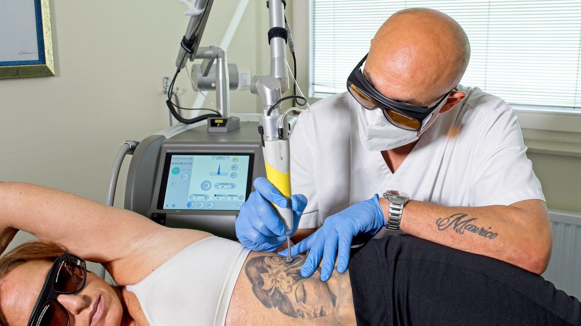 Ein Mann lässt einer Frau ein Tattoo vom Rücken entfernen.