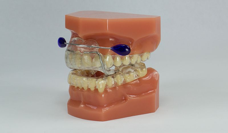 Model of Upper and Lower Teeth