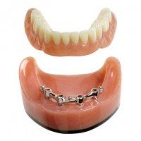 A close up of a denture with braces on it on a white background.