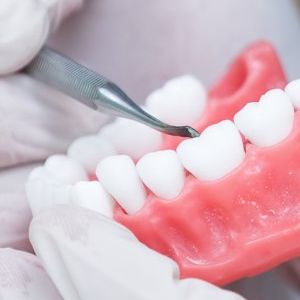 Un dentiste travaille sur un modèle des dents d'une personne.