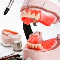 Un modèle de dents d'une personne avec un stylo en arrière-plan.