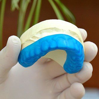 A person is holding a blue mouth guard in their hand.