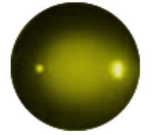 Nuclear Sclerotic Cataracts