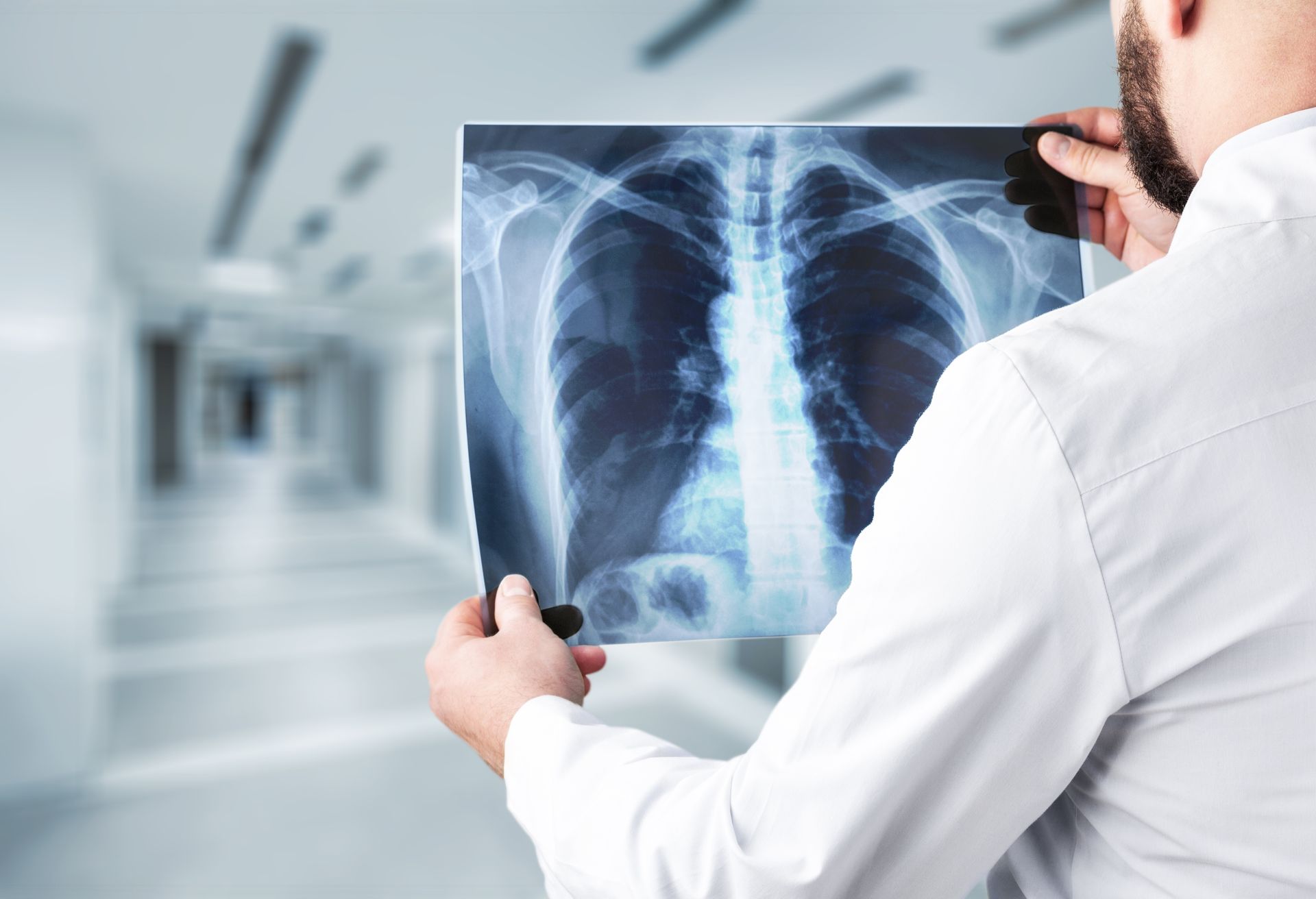 back of doctor holding a large X-ray of chest