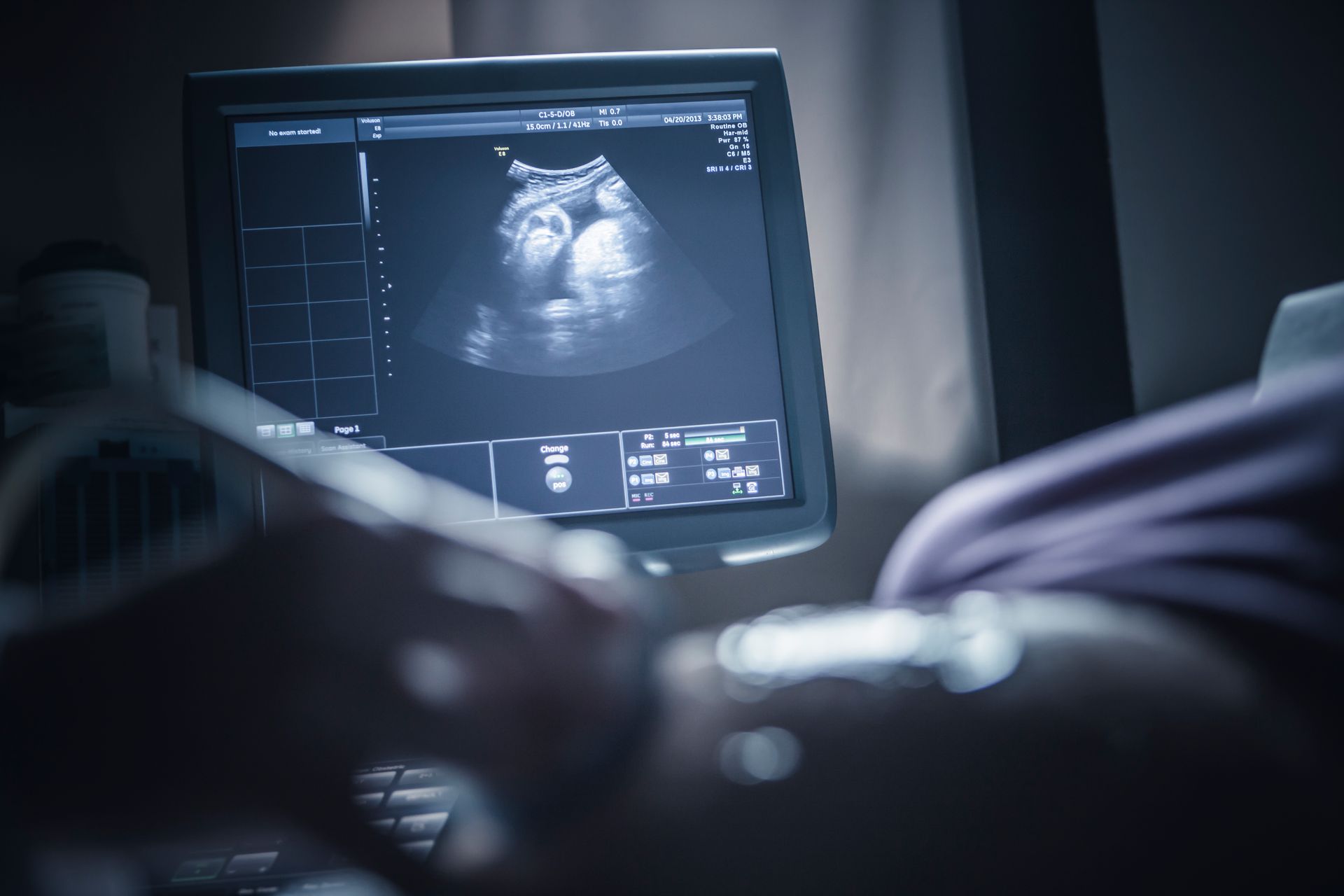 Ultrasound Services