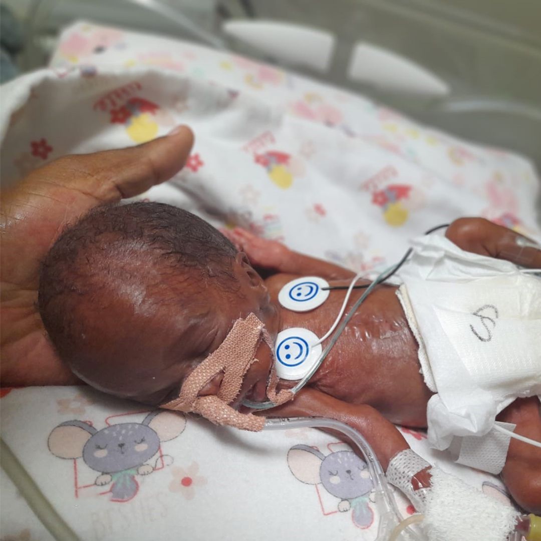 Tshiamo weighed only 585 grams at birth.