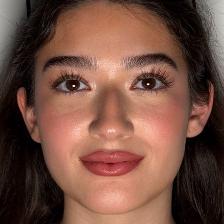 Skin after treatment