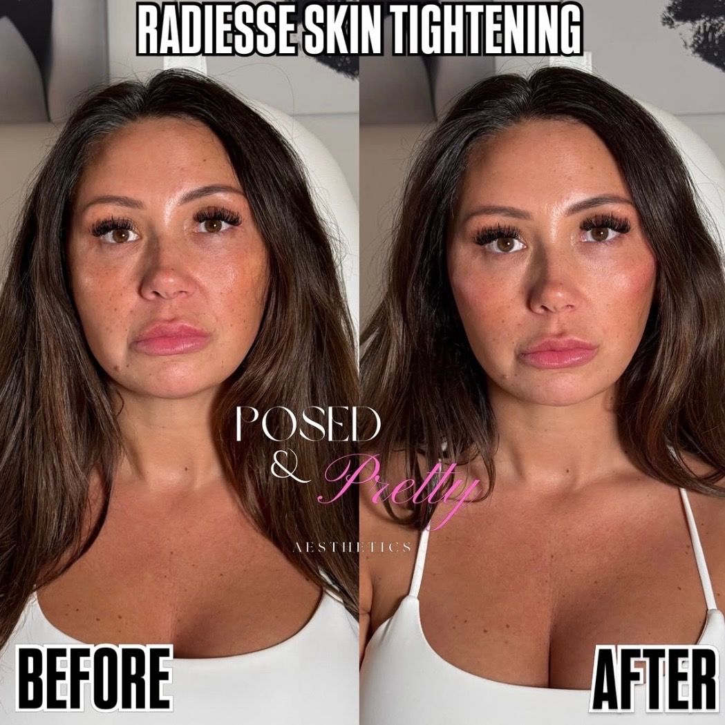 Skinboosters dewy glass skin close-up