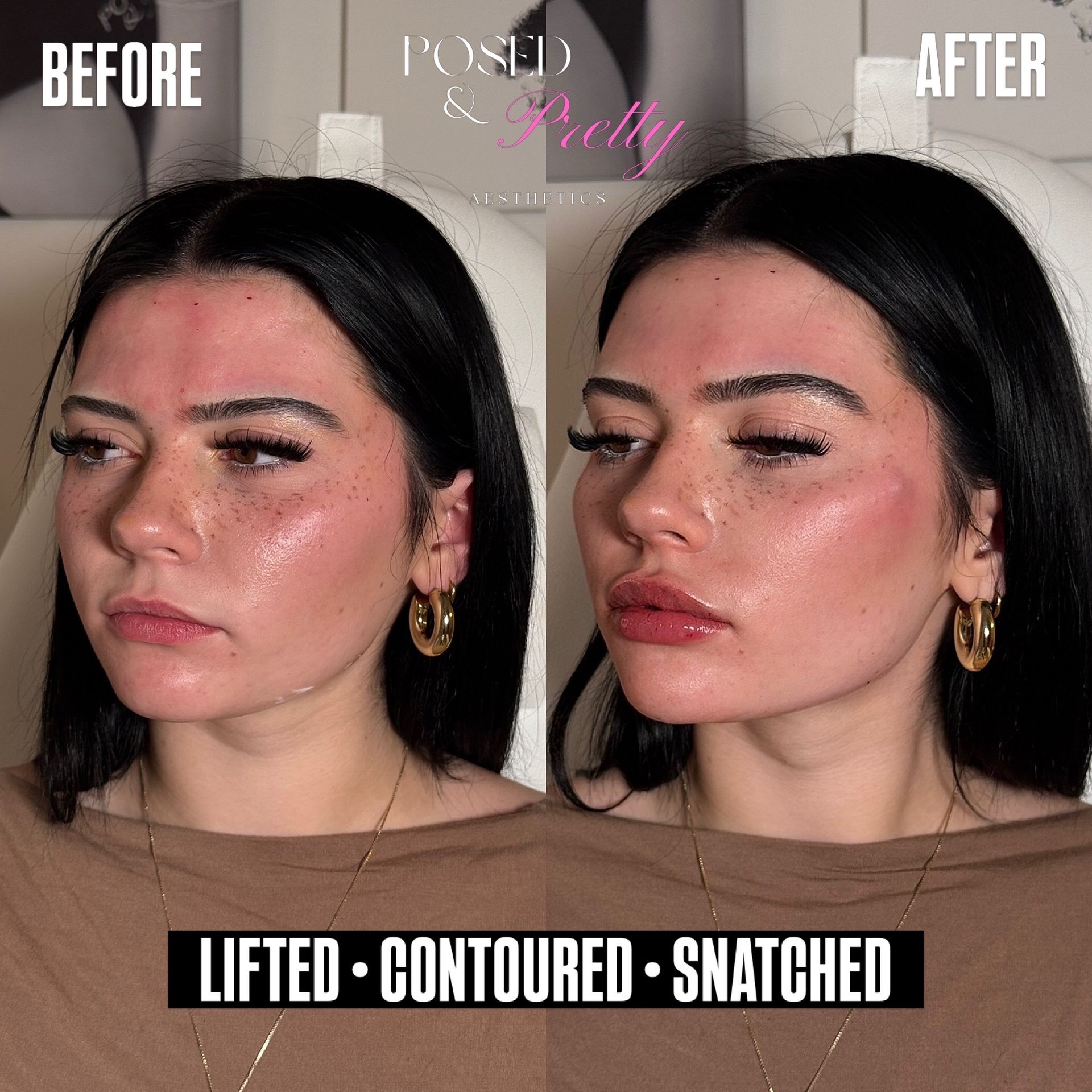Before Skin Glow