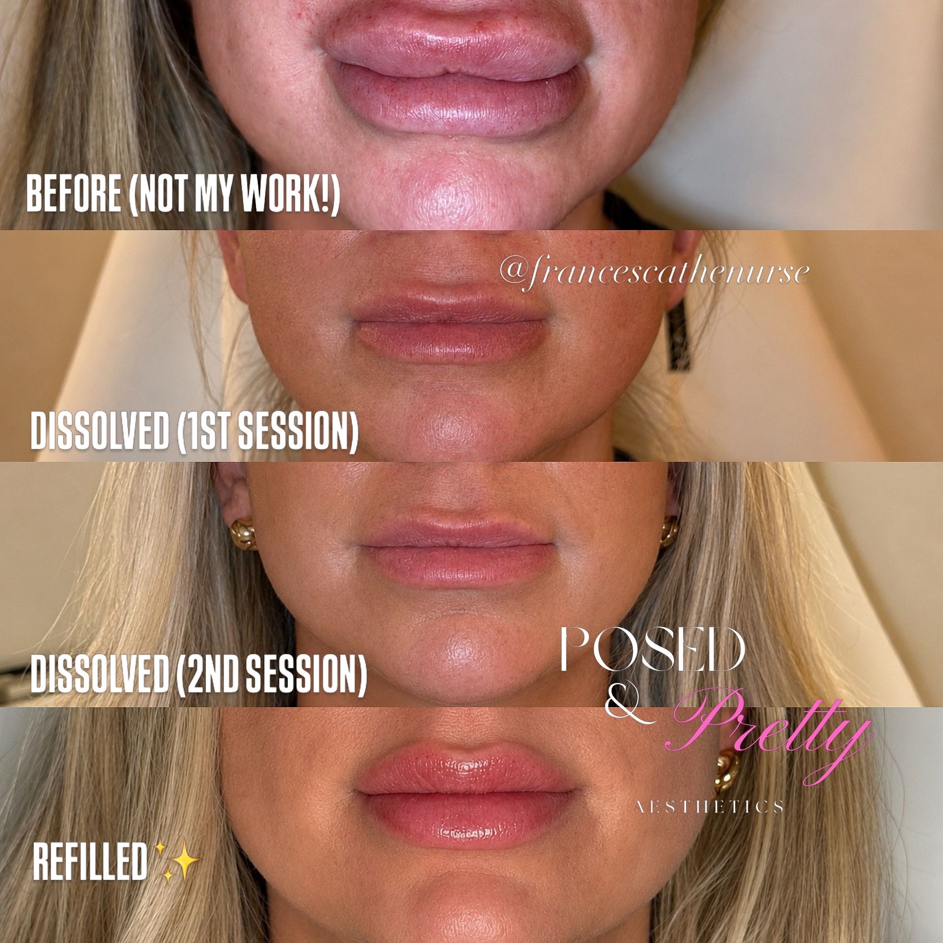 Before Skin Glow 2