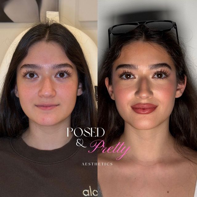 Facial Contouring treatment