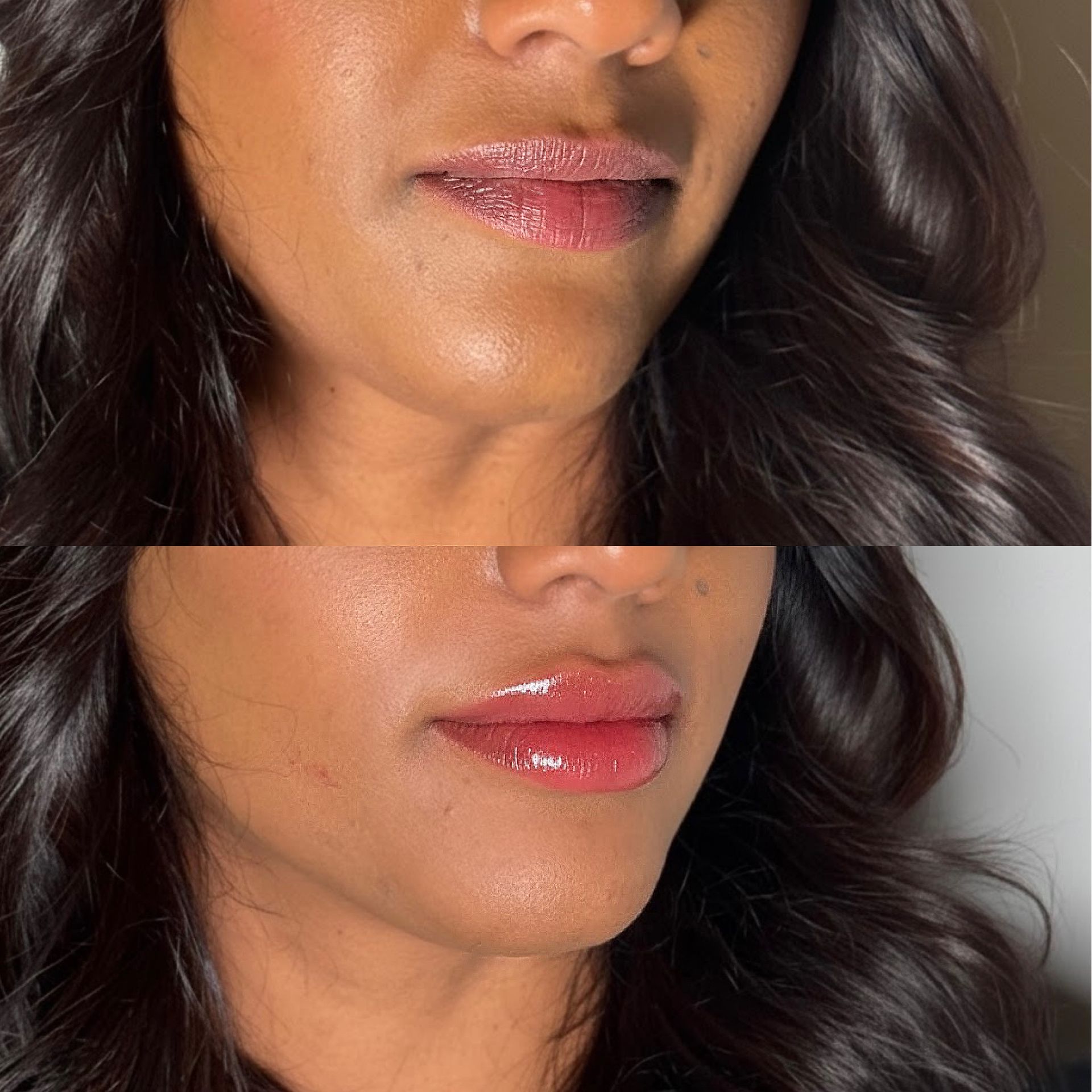 After Skin Glow 2