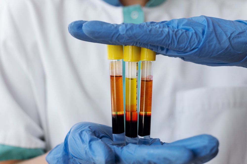 Mãos enluvadas segurando três tubos de ensaio com amostras de sangue em camadas, em um ambiente de laboratório.