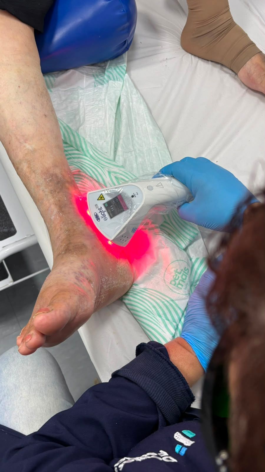 Pessoa utilizando um scanner portátil com luz vermelha no pé de um paciente em um ambiente clínico.