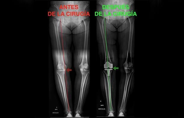 DR JORGE DE LA VEGA - CIRUGIA DE RODILLAS