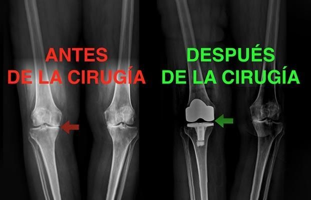 DR JORGE DE LA VEGA - TRAUMATOLOGIA Y ORTOPEDIA