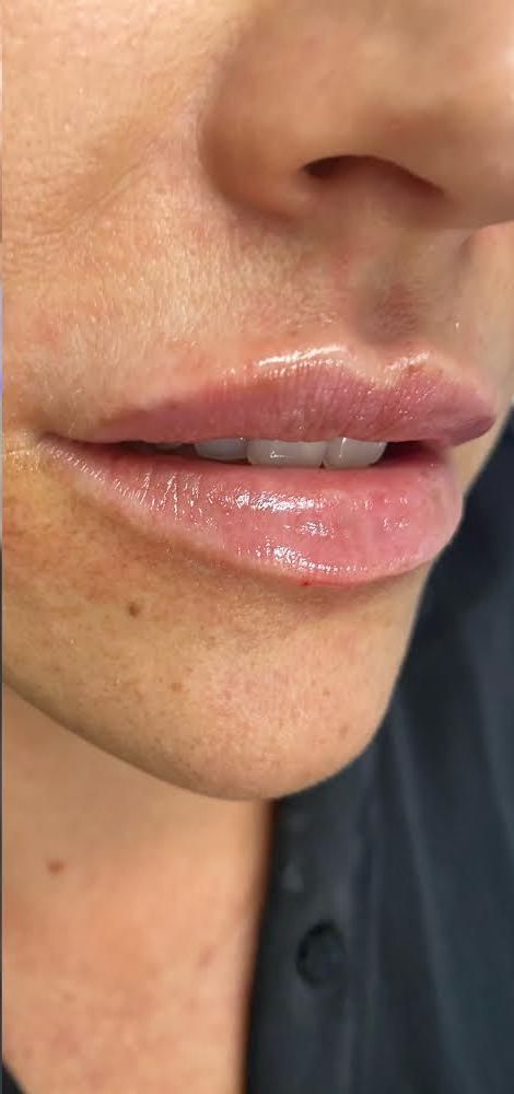 Close-up of a person’s lips and nose, wearing glossy pink lip color.
