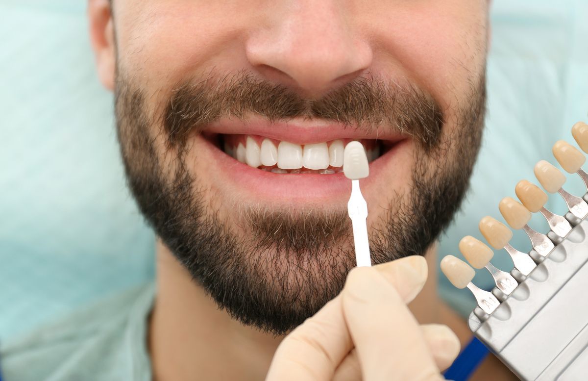 Man smiling, checking dental veneers
