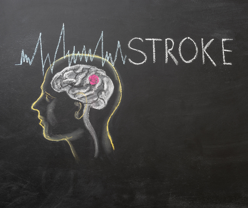 drawing showing the mind of a stroke victim