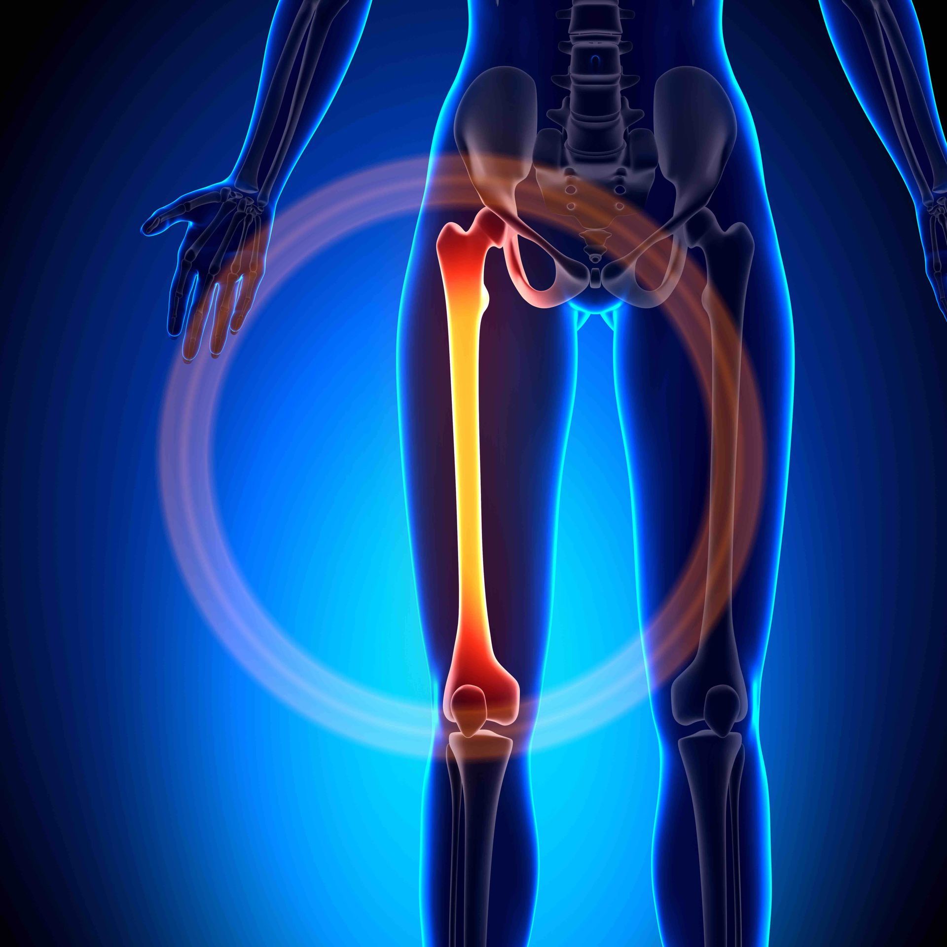 Sunrise Hospital. Patient-101 had a broken femur. Stock photo of femur.