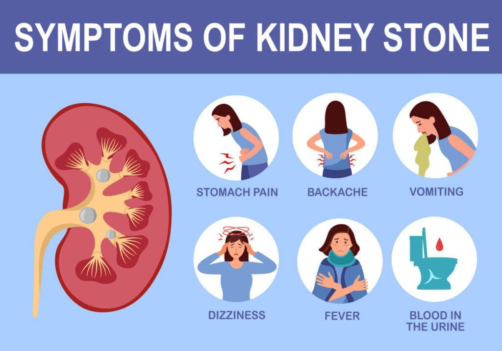 Sunrise Hospital. Patient-133, symptoms of kidney stones Sunrise Hospital. Patient-133, symptoms of kidney stones