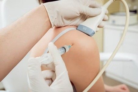 Patient-142, stock photo of ultrasound-guided shoulder injection