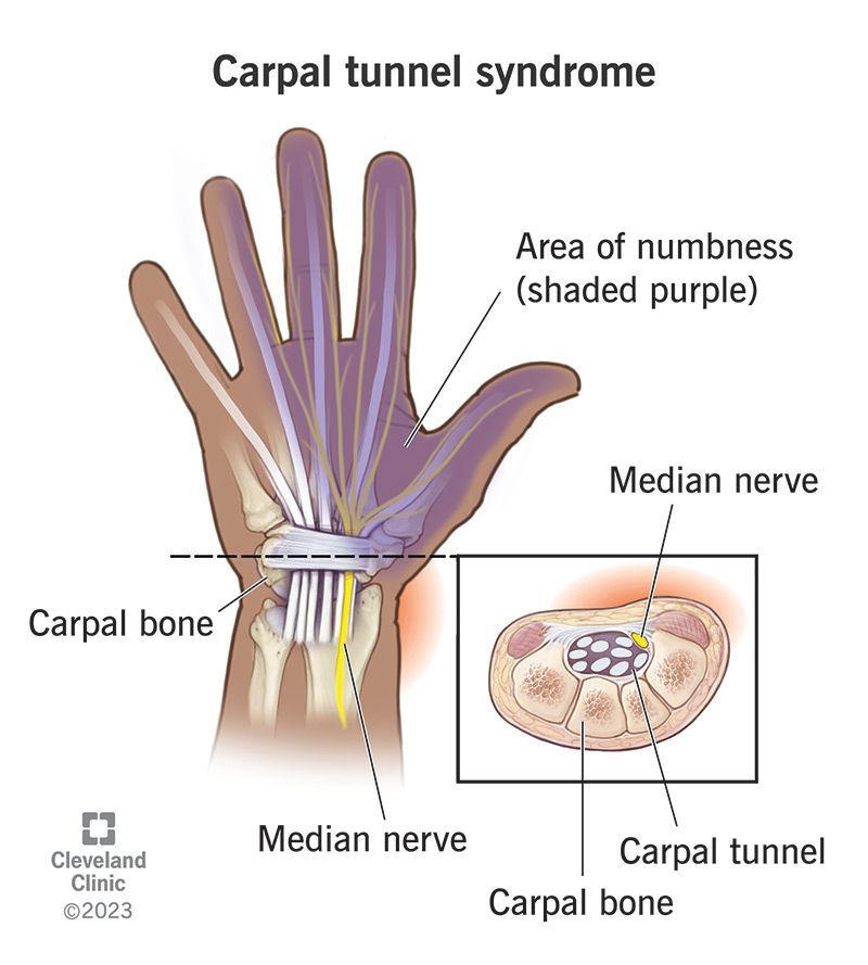Sunrise Hospital, Patient 174 had carpal tunnel and had a bad experience with Dr. Arthur Taylor. Sunrise Hospital, Patient 174 had carpal tunnel and had a bad experience with Dr. Arthur Taylor.