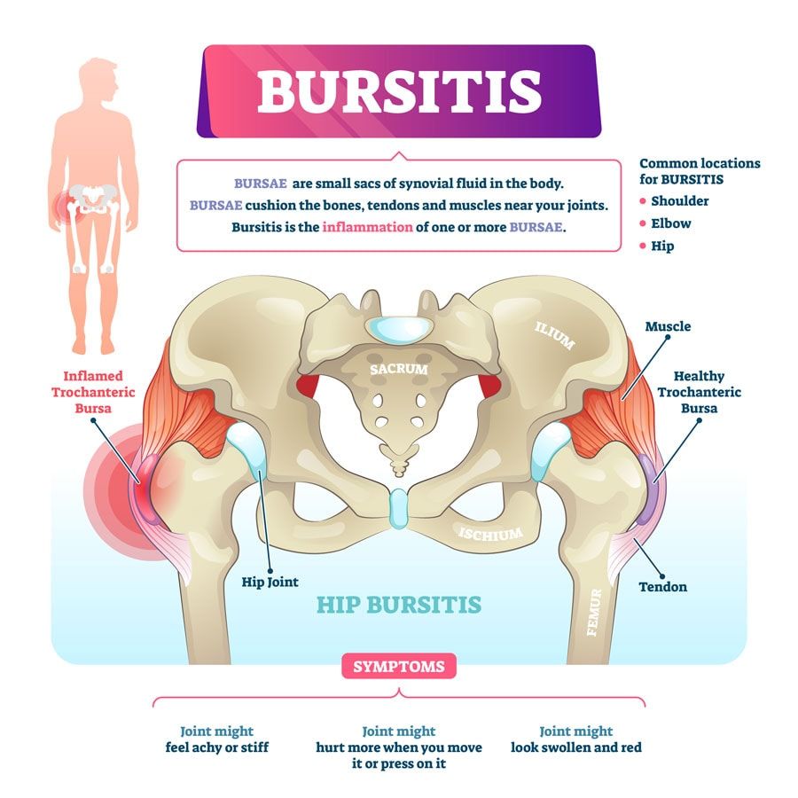 Nevada Orthopedic. Patient 177. Dr. Holman Chan misdiagnosed the patient with a fractured hip, but it was actually hip bursitis. Nevada Orthopedic. Patient 177. Dr. Holman Chan misdiagnosed the patient with a fractured hip, but it was actually bursitis.