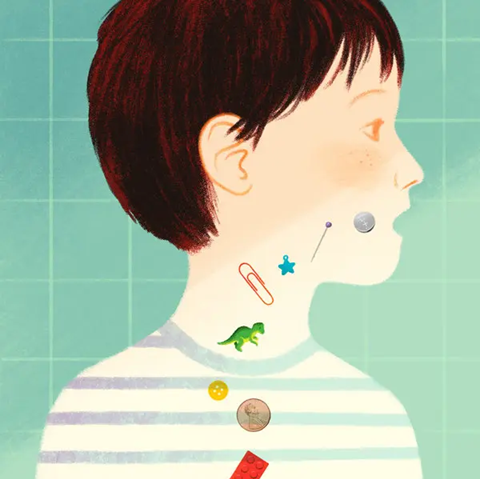 Sunrise Children's Hospital, Patient-273, other items that children sometimes swallow. Sunrise Children's Hospital, Patient-273, other items that children sometimes swallow.