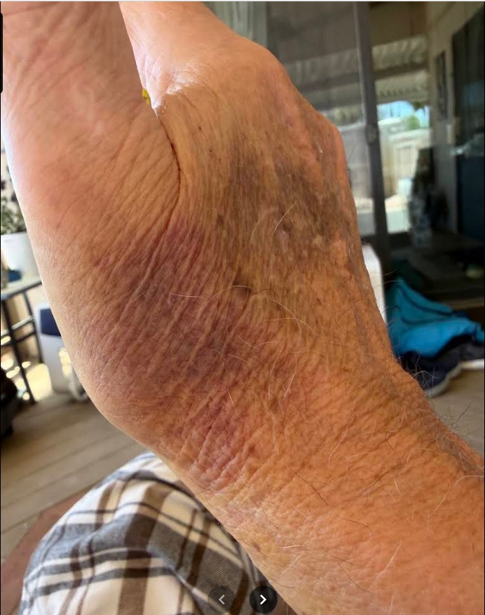 Sunrise Hospital, Patient-275 with a neck fracture, brain bleed and sprained hands. Horrible care, never saw a doctor and was discharged with no care plan.