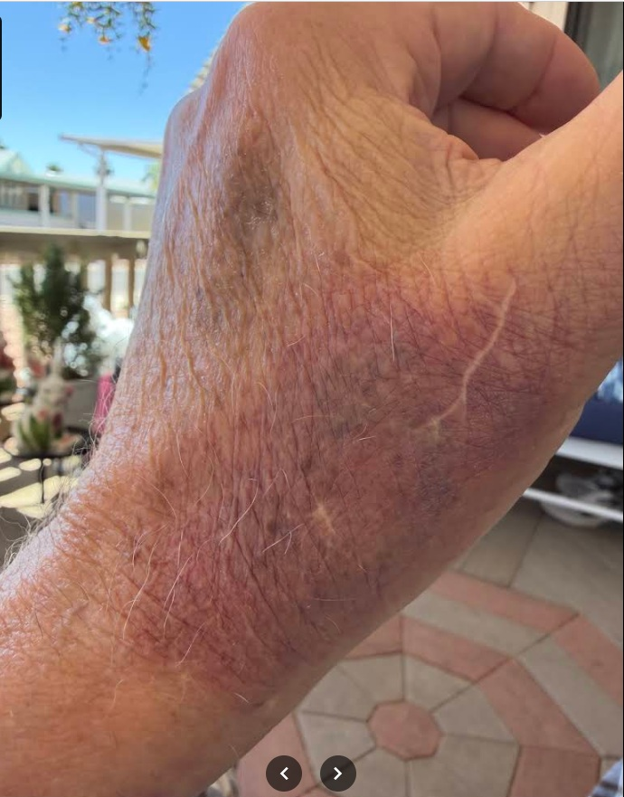 Sunrise Hospital, Patient-275 with a neck fracture, brain bleed and sprained hands. Horrible care, never saw a doctor and was discharged with no care plan.