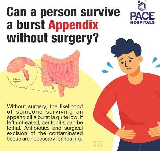 Sunrise Hospital, Patient-289, Can a patient survive a burst appendix without surgery? Sunrise Hospital, Patient-289, Can a patient survive a burst appendix without surgery?