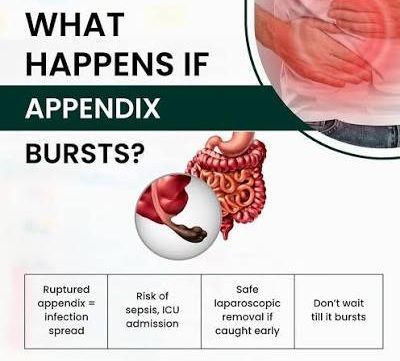Sunrise Hospital, Patient-289, What Happens if Appendix Bursts Sunrise Hospital, Patient-289, What Happens if Appendix Bursts