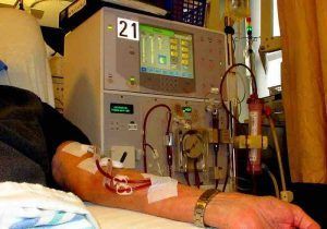 Sunrise Hospital, Patient-309-stock-photo-of-patient-receiving-dialysis Sunrise Hospital, Patient-309-stock-photo-of-patient-receiving-dialysis