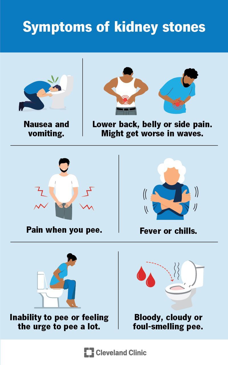 Sunrise Hospital, Patient-329, symptoms of kidney stones Sunrise Hospital, Patient-329, symptoms of kidney stones