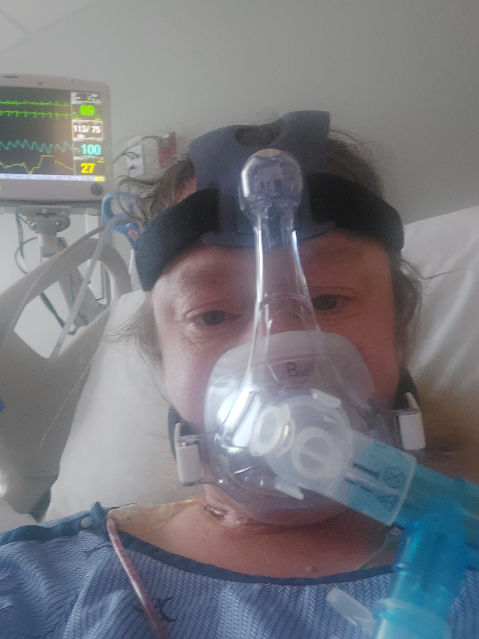 Sunrise Hospital, botched surgery, left the patient without a voice box Sunrise Hospital, botched surgery, left the patient without a voice box