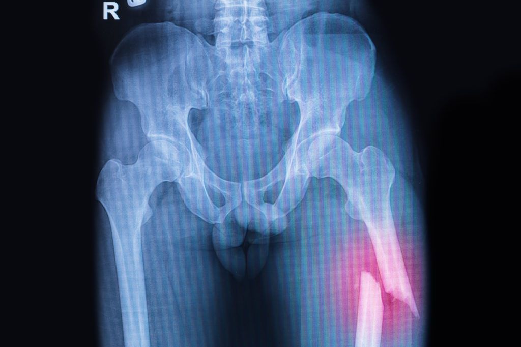 Another case of Nevada Orthopedic refusing to approval a referral Another case of Nevada Orthopedic refusing to approval a referral