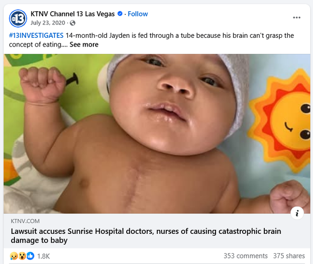 Sunrise Hospital, Patient-2, baby suffered catastrophic brain injury Sunrise Hospital, Patient-2, baby suffered catastrophic brain injury
