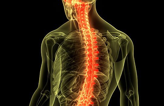 Sunrise Hospital. Patient-17, stock photo of a spinal cord Sunrise Hospital. Patient-17, stock photo of a spinal cord