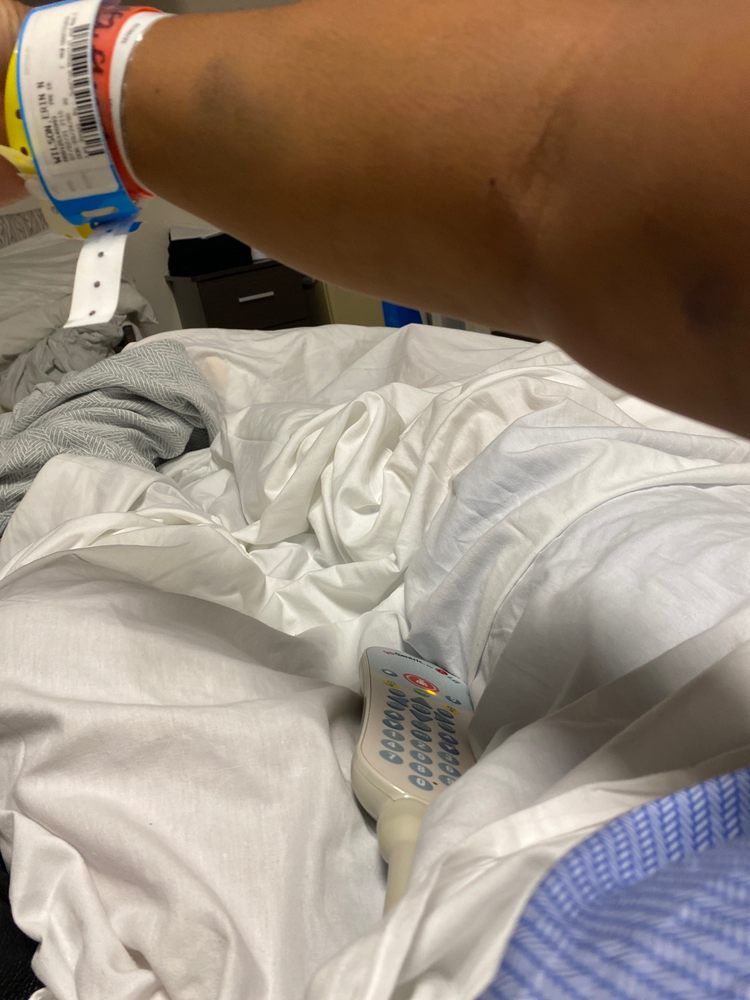 Another blown IV at Sunrise Hospital
