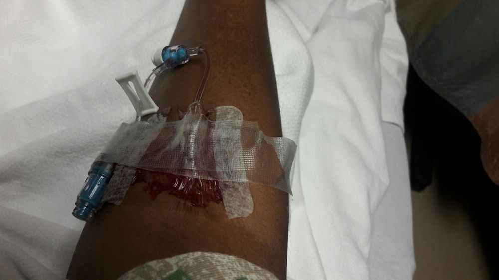 Sunrise Hospital, patient arm damaged by a blown IV