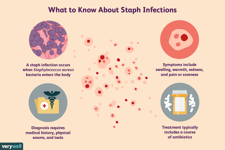 Sunrise Hospital, no treatment, no diagnosis, patient later went to ENT who found staph infection Sunrise Hospital, no treatment, no diagnosis, patient later went to ENT who found staph infection