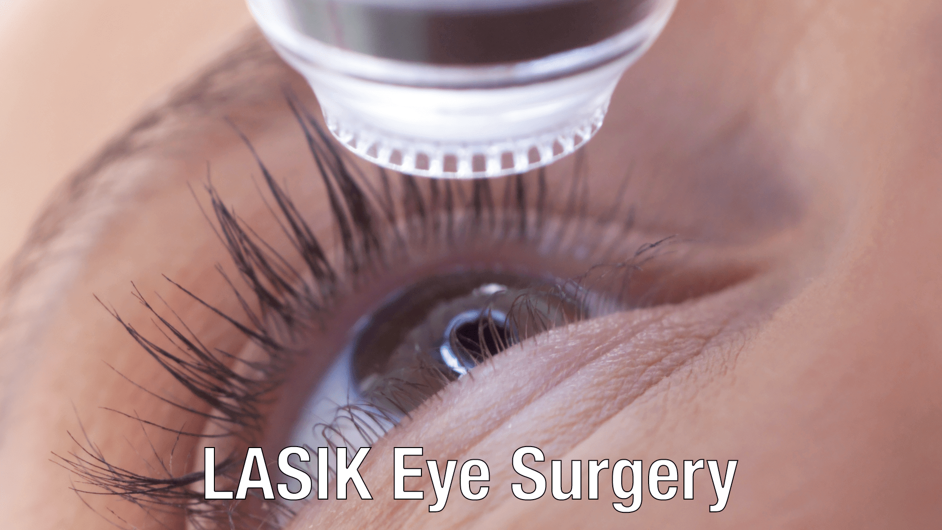 Eye with LASIK surgery instrument.