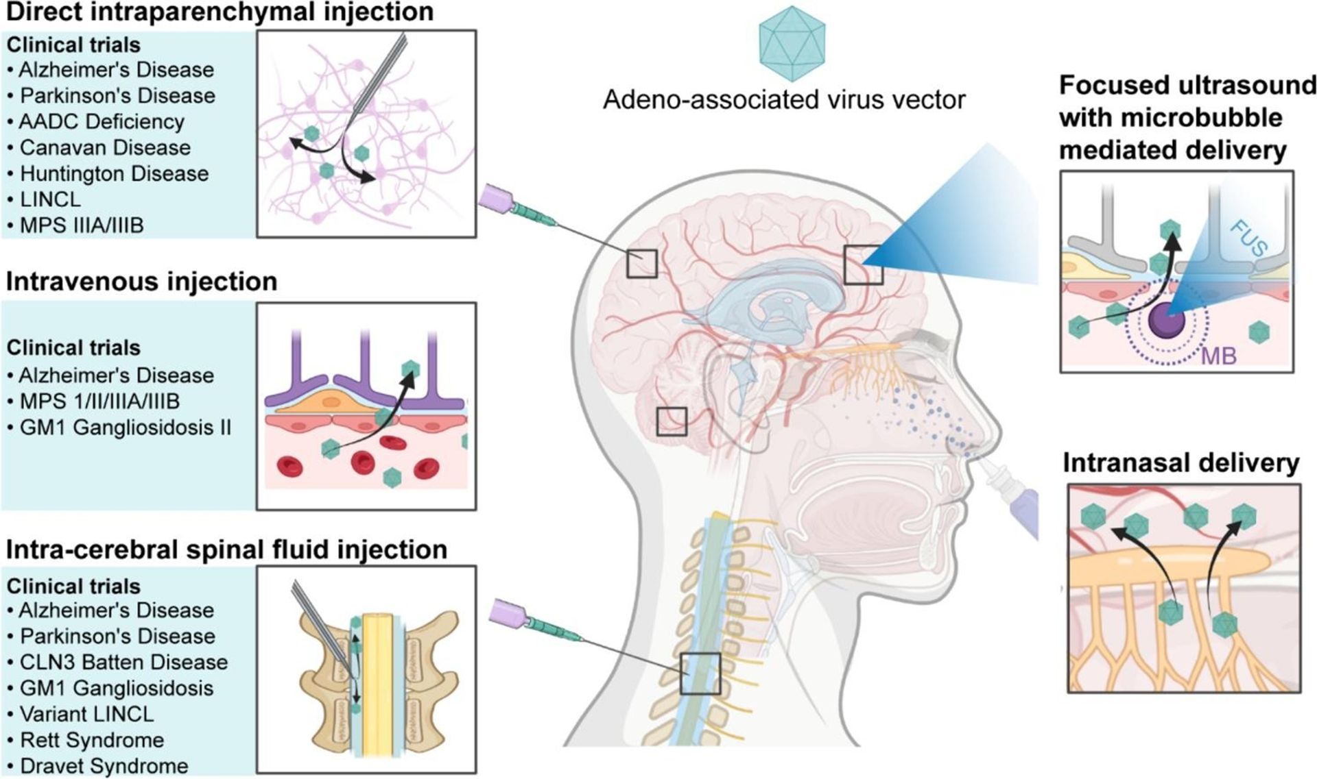 Diagram of the human head and spinal cord