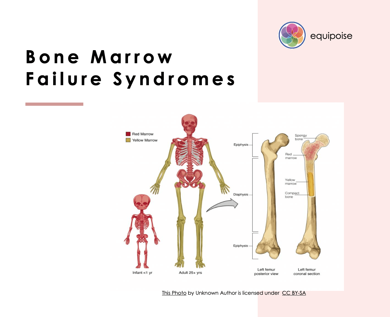 bone marrow failure syndromes brochure