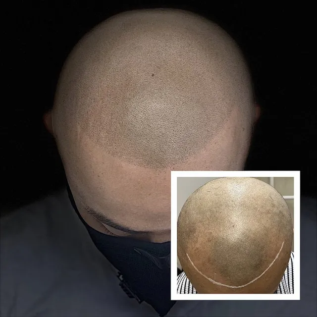 SMP Work before and after